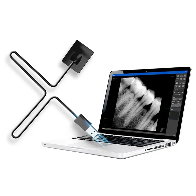 Sensore Radiografico Dentale D - Medical Supplies recensione e prezzo